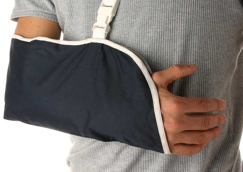 A person's arm slung in a temporary cast.